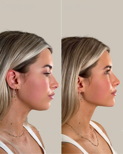 La Brosse Sculptante – Chandra